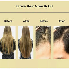 Thrive Hair Growth Essential Oil